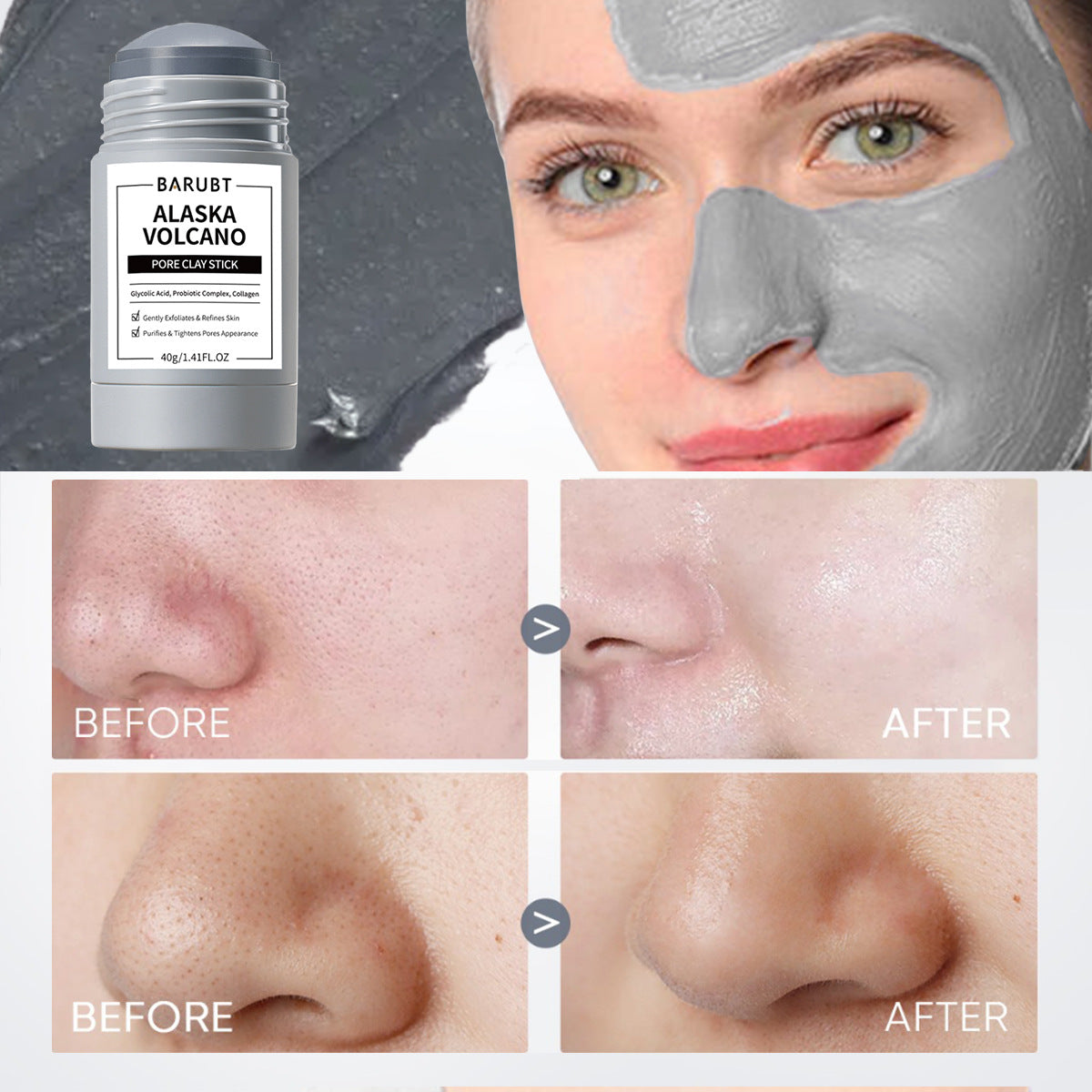 Volcano Mask Black Head Remover