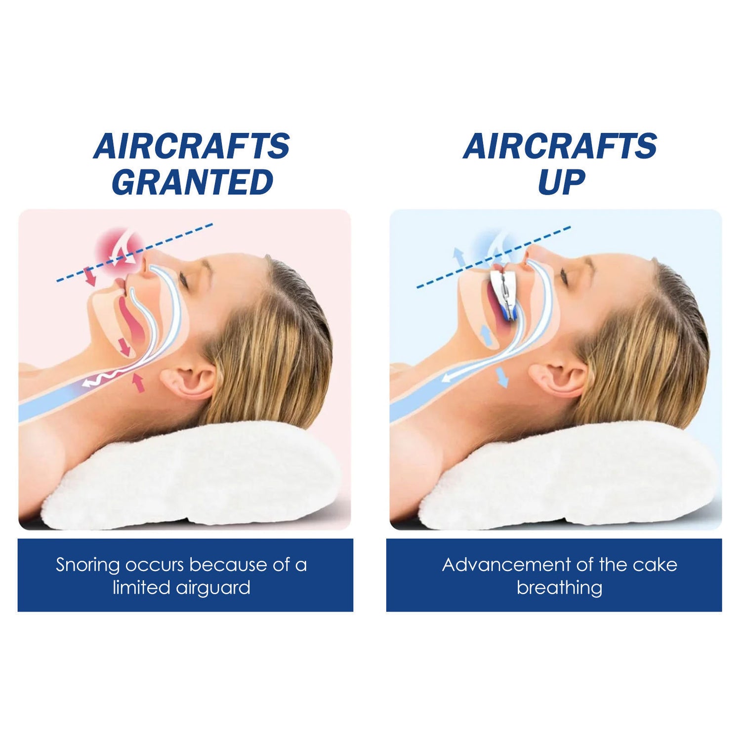 Anti-Snoore Mouth Piece